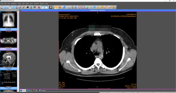 医疗影像存储系统服务器软件Sante PACS Server PG v4.4.1 安装最新免费版