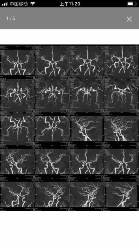 血管卫士 for android v1.1.6 安卓手机版